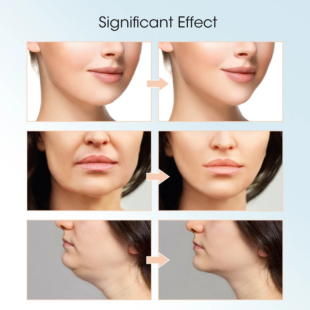 V-Line Face Slimming Lifting Device Massager Skin Rejuvenation Shaping Beauty Instrument Electric Reduce Double Chin Belt Mary's For You